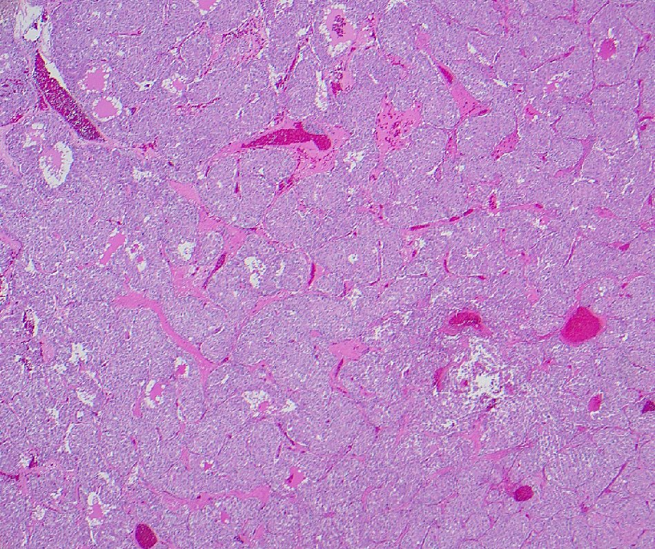 megothelioma's tweet image. How would you describe this architectural pattern, #pathresidents?

#PathTwitter