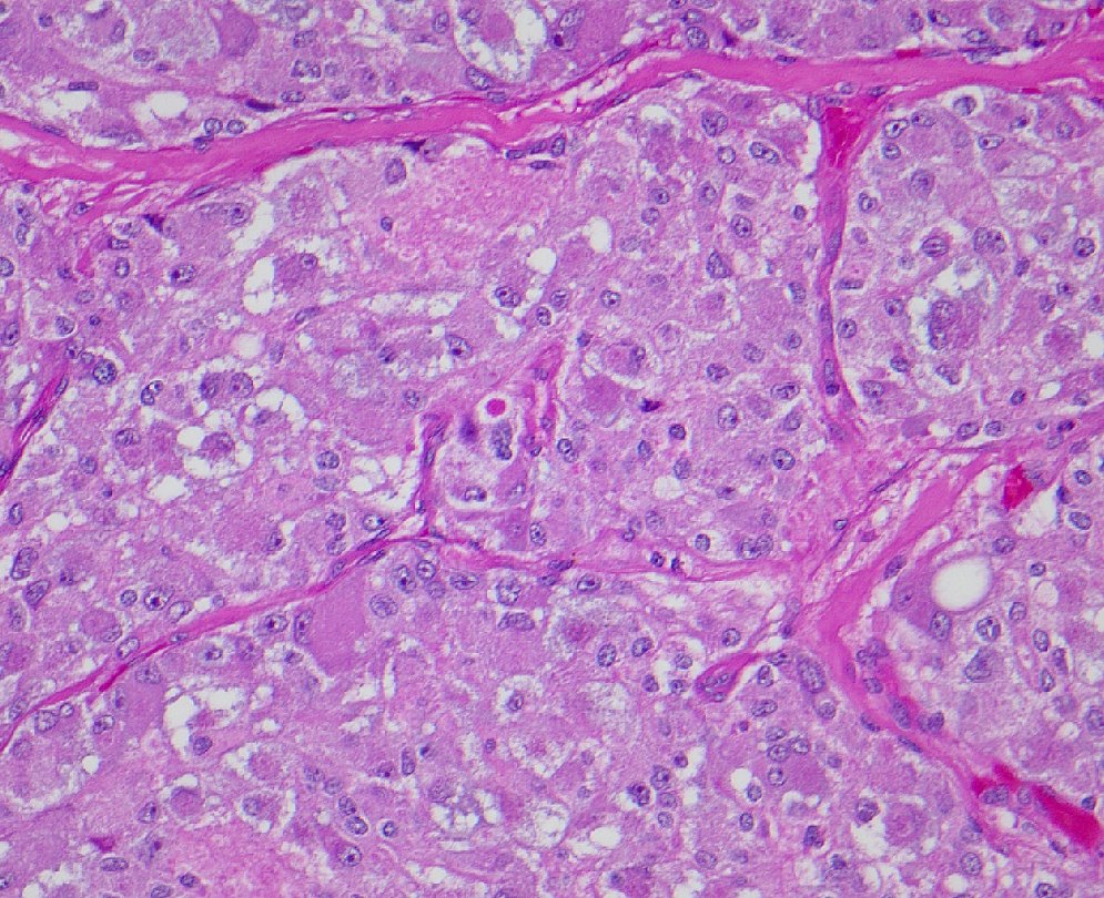 megothelioma's tweet image. How would you describe this architectural pattern, #pathresidents?

#PathTwitter