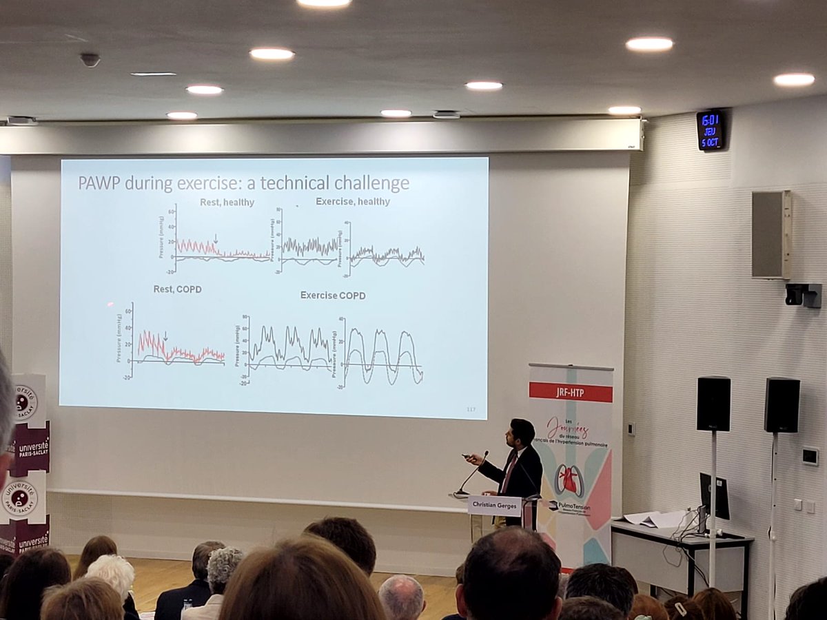 🔴 [#JRFHTP]  Session I : La presentation du Dr. @ChristianGerges sur le #cathétérisme cardiaque droit à l'exercice : est-ce vraiment utile ? @MeduniVienna @pulmotension