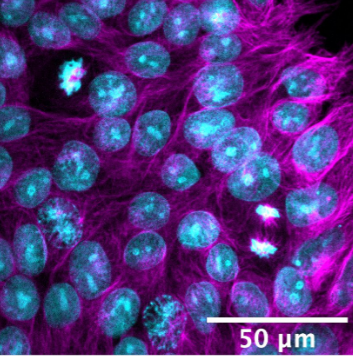 Vanderbilt Cell Imaging Shared Resource (@vucellimaging) on Twitter photo New paper from the Ess Lab and @IhrieLab with first author <a href="/marychalkley/">Mary Chalkley, Ph.D.</a>. "Non-canonical functions of a mutant TSC2 protein in mitotic division". Thank you for using and acknowledging the CISR! journals.plos.org/plosone/articl… New paper from the Ess Lab and @IhrieLab with first author <a href="/marychalkley/">Mary Chalkley, Ph.D.</a>. "Non-canonical functions of a mutant TSC2 protein in mitotic division". Thank you for using and acknowledging the CISR! journals.plos.org/plosone/articl…