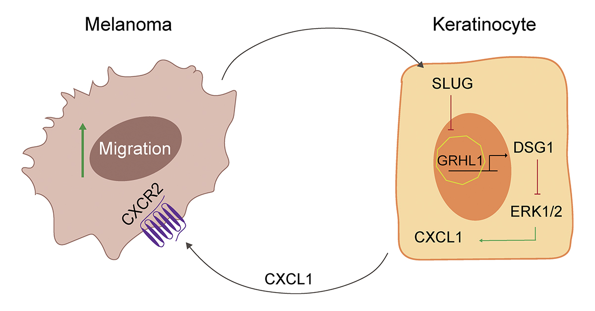 Model showing how bi-directional paracrine signaling between #melanoma cells and keratinocytes potentiates melanoma cell movement. From Hope Burks (<a href="/HopeEBurks/">Hope Burks</a>) Kathleen Green <a href="/KathyGreenLab/">The Green Lab</a> <a href="/NUFeinbergMed/">Northwestern Feinberg School of Medicine</a> and colleagues: bit.ly/3LBdQXd
#Cancer #CellSignaling #desmosomes