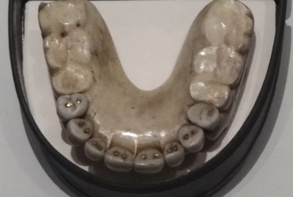 Following the Battle of Waterloo in 1815, looters, scavengers, and even surviving soldiers began pulling the teeth from lifeless soldiers left on the battlefield. They'd sort them into sets, and sell them to dentists who would boil them, cut off their roots, and shape them into