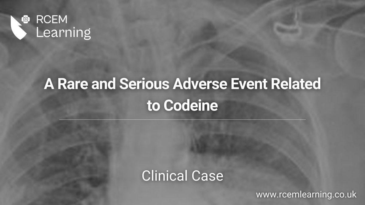 RCEMLearning tweet media