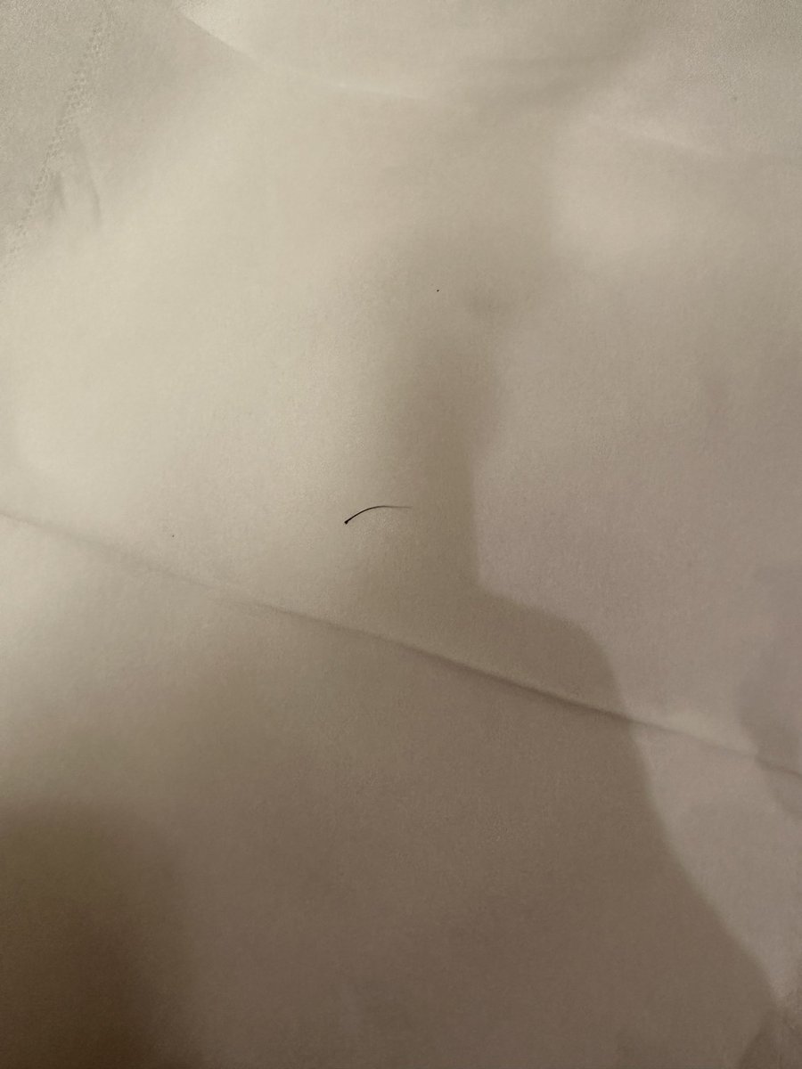 髭が白髪になったと言いましたが、なぜが黒く戻って来ました！

一時的なDTストレス？

画像載せました
先っぽだけ白くて根本は黒い

エクソソームやったら全部黒くなるかな

#rex 
#切開リフト 
#バッカルファット 
#メーラーファット
#整形垢 
#韓国 
#整形
#ANA
#voco
#ダウンタイム
#メンズ美容