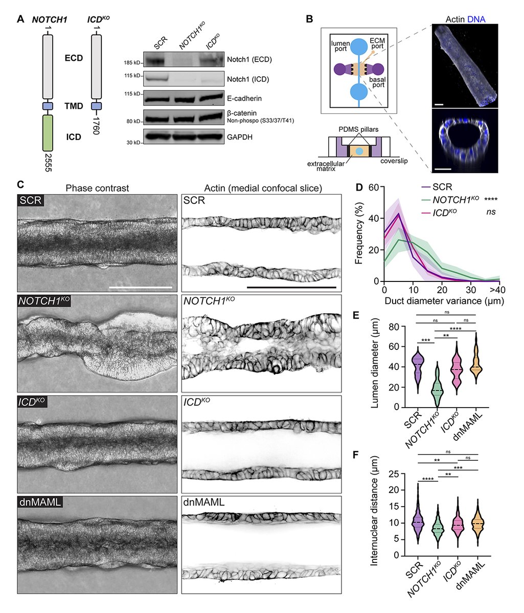 JCellBiol's tweet image. White et al. @kutyslab @CTB_at_UCSF show that Notch1 influences epithelial #morphogenesis through a mechanism independent of transcriptional signaling that involves direct stabilization of adherens junctions and cortical #actin through the effector FAM83H. bit.ly/3rBzVyd
