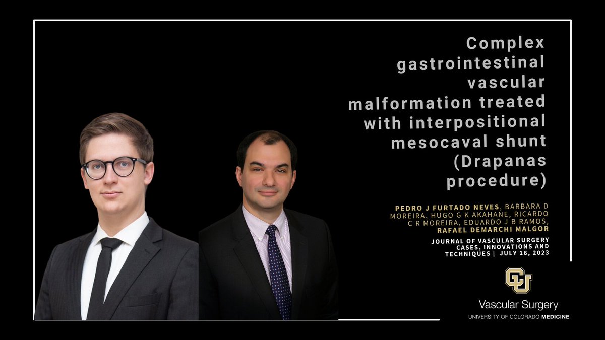 CUVascularSurg's tweet image. Fascinating case study on complex GI vascular malformation treated with interpositional mesocaval shunt (Drapanas procedure) by Drs. @Pedro_FNeves_MD, @RafaMalgor &amp;amp; their colleagues in Brazil.
Learn from their expertise in this area of medicine. Read more: doi.org/10.1016/j.jvsc…