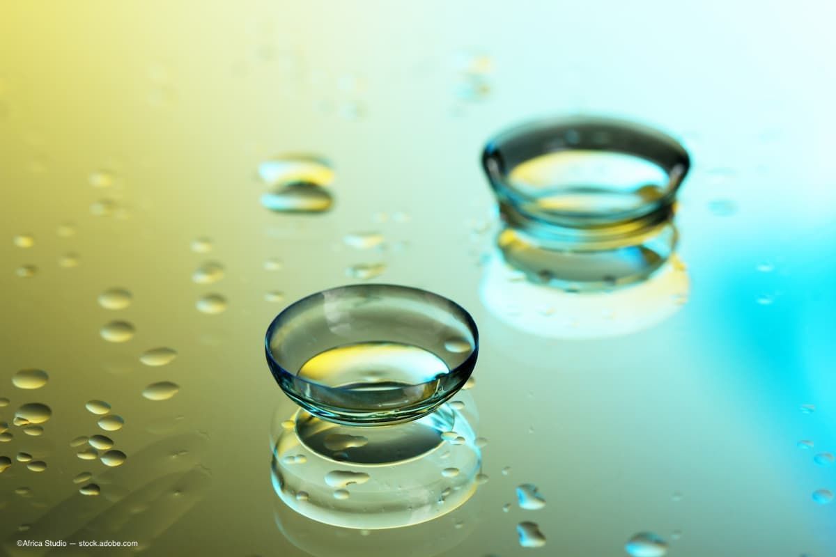 OphthTimes's tweet photo. Prevent Blindness promoting contact lens safety and the organization is warning the public about the hazards of misusing contact lenses. Contact lens wearers also must take extra care when applying and removing eye cosmetics.

Read More: https://t.co/mY99iprkau https://t.co/4HTobWHsoS