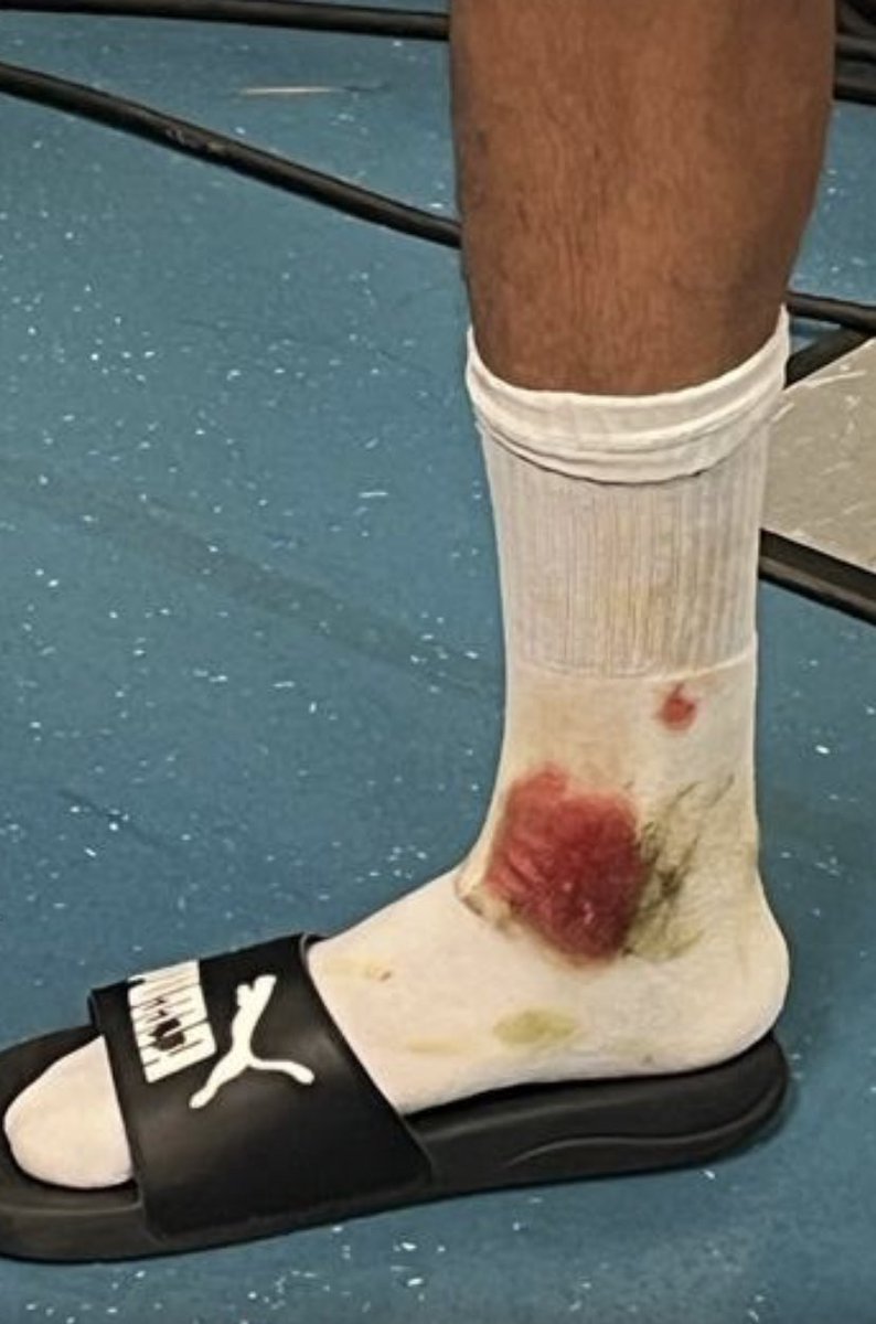 La cheville d'Amine Harit 😨

Le joueur de Brighton n'a même pas été sanctionné et a pu au final provoquer le pénalty égaliseur en fin de match.

Encore une fois, l'arbitrage européen face aux clubs français laisse à désirer...

📸 <a href="/karimattab1/">Karim Attab</a>