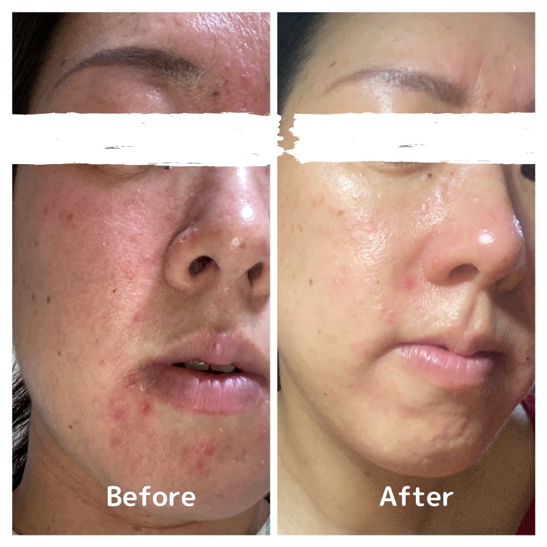 ジェーン tweet media