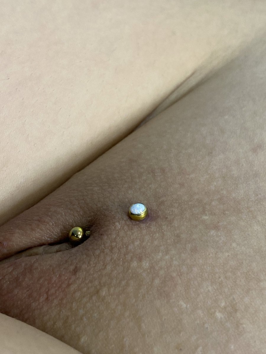 reyes_piercing's tweet photo. Cristhina ❤️ -Ti😊—😊trabajo hecho por mi ✌🏻 agenda disponible  3123116058 calle 11 entre av 3y4 3-28 Centro Cúcuta  TRAZO FINO 𝖙𝖆𝖙𝖙𝖔𝖔 Gracias.👉🏻 no olviden seguirme en esta cuenta @reyes_piercing #cucuta #cúcuta #piercingcucuta #perforacionescucuta 
#microdermal #colombia https://t.co/H3I7rI2sC7