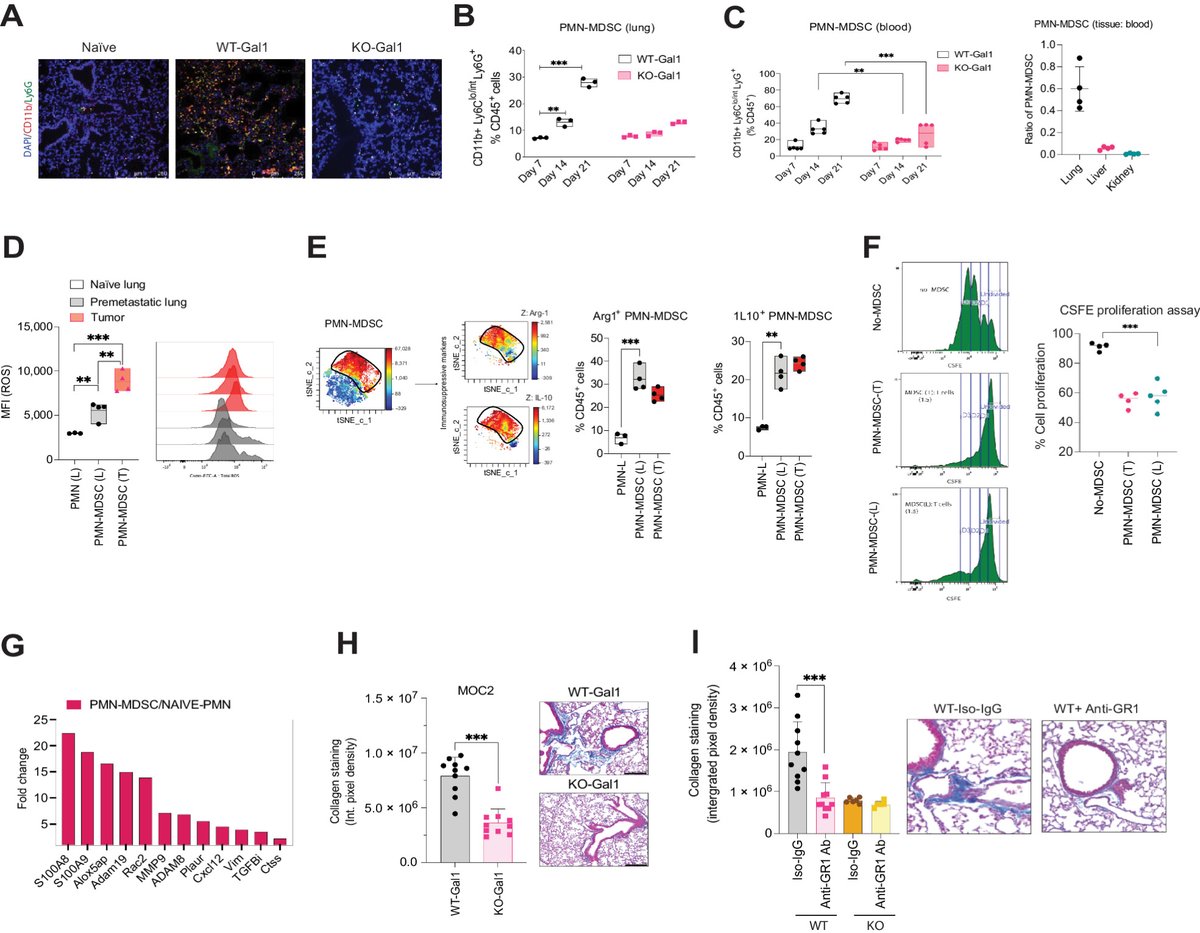 Cancer Research (@cr_aacr) on Twitter photo Read the article in the latest issue—
Galectin-1 Mediates Chronic STING Activation in Tumors to Promote #Metastasis through MDSC Recruitment, by <a href="/dnambiar_86/">Dhanya Nambiar</a>, <a href="/Qle_stanford/">Quynh Thu Le</a> et al.
bit.ly/3F6J8lm
<a href="/StanfordMed/">Stanford Medicine</a> Read the article in the latest issue—
Galectin-1 Mediates Chronic STING Activation in Tumors to Promote #Metastasis through MDSC Recruitment, by <a href="/dnambiar_86/">Dhanya Nambiar</a>, <a href="/Qle_stanford/">Quynh Thu Le</a> et al.
bit.ly/3F6J8lm
<a href="/StanfordMed/">Stanford Medicine</a>