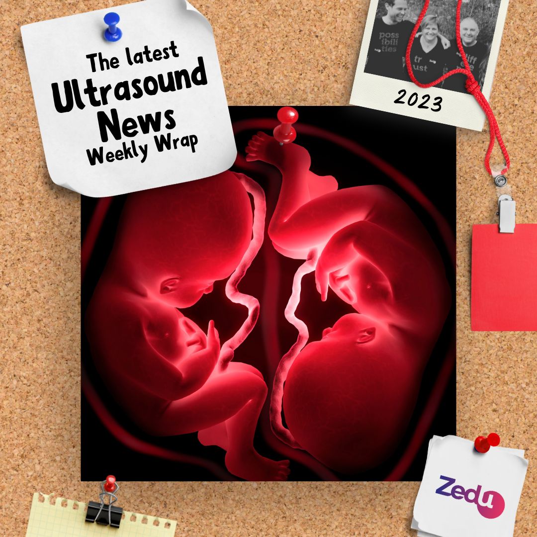 The latest free #ultrasound news, views & information has landed in the #weeklywrap Featuring @jeffgadsden @MH_EMultrasound @FrontiersIn @WINFOCUS @Crit_Care This & more all in one handy spot ultrasoundtraining.com.au/news/zedu-week… #FOAMed #MedEd #FOAMus #POCUS