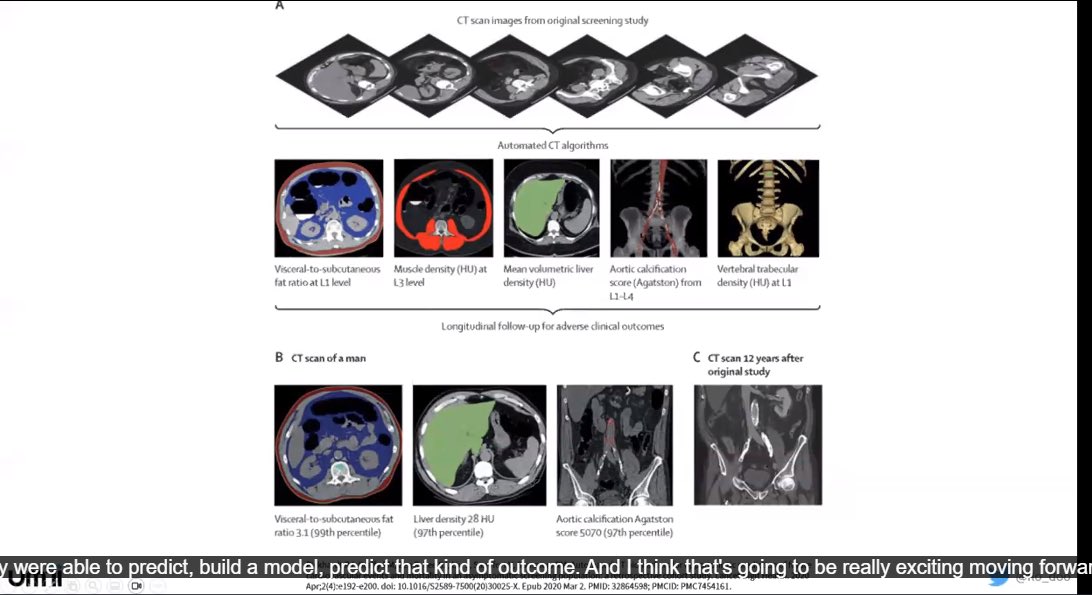 AIRE (@airaded) on Twitter photo What a great two days!!! Fantastic sessions on AI in Neuroradiology with Dr. Marwa Ismail, AI in Body Imaging with <a href="/flo_doo/">Flo Doo, MD</a>, and AI in Chest Imaging with <a href="/farouk_dako/">Farouk Dako</a>, and a look into the future of Radiology AI with <a href="/EliotSiegel/">Eliot Siegel</a> What a great two days!!! Fantastic sessions on AI in Neuroradiology with Dr. Marwa Ismail, AI in Body Imaging with <a href="/flo_doo/">Flo Doo, MD</a>, and AI in Chest Imaging with <a href="/farouk_dako/">Farouk Dako</a>, and a look into the future of Radiology AI with <a href="/EliotSiegel/">Eliot Siegel</a>