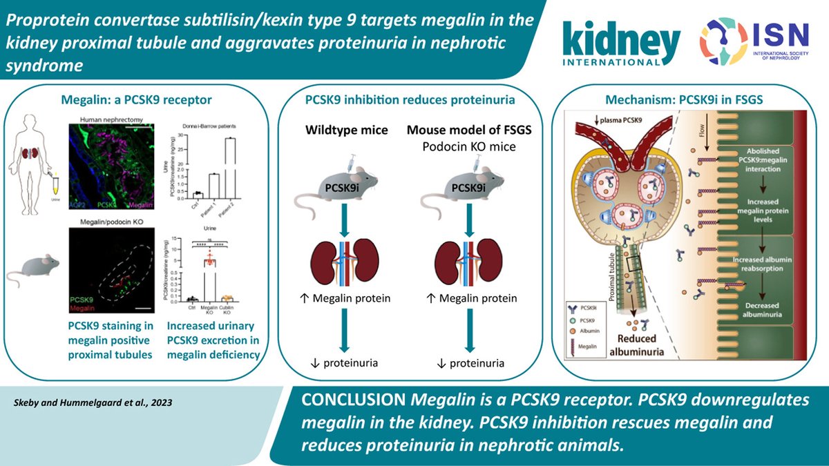 ISNkidneycare's tweet photo. 📖 This weekend don't miss our @Kidney_Int #ISNFridaySelection: Proprotein convertase subtilisin/kexin type 9 targets megalin in the kidney proximal tubule and aggravates proteinuria in nephrotic syndrome https://t.co/M4zTJcepqa https://t.co/HiARs0ITR3