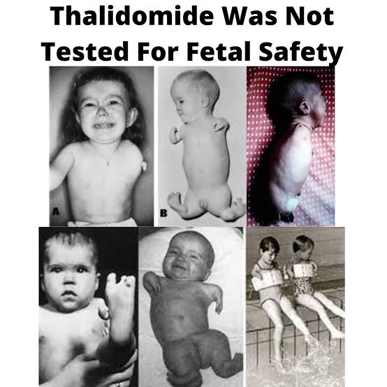 PeterItebimien's tweet photo. @simplify_drugs " Thalidomide"a drug first marketed to treat anxiety and morning sickness.Despite claims that the drug was safe during pregnancy,it was removed from the market in the 1960s when clinicians noted an association with phocomelia. Its currently use to treat myeloma &amp; Hansen's disease https://t.co/JJfgqFDgKk