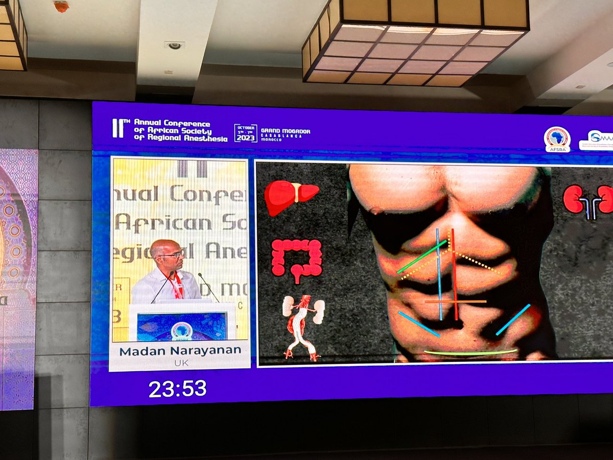 AFSRA10's tweet photo. What is the best #RegionalAnaesthesia for abdominal surgeries , another interesting talk to @MadanNarayanan
#AFSRA23
@ezzatsamyaziz
@ESRA_Society
@RegionalAnaesUK https://t.co/lZJ3lTOmSo