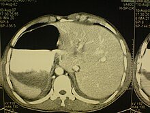 barriere_dr's tweet photo. @Fraslin Faux !!!!!
🤓
#SitusInversus https://t.co/qmz2ECyKoT