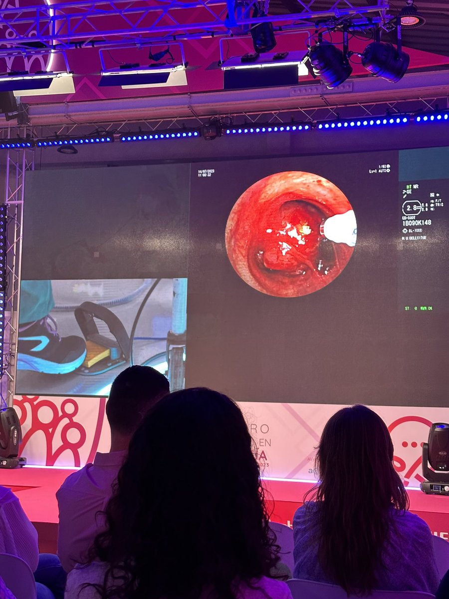 Interesante caso sobre obstrucción de vía aérea central en el 3 #videoforo nacional de #neumologia 🫁