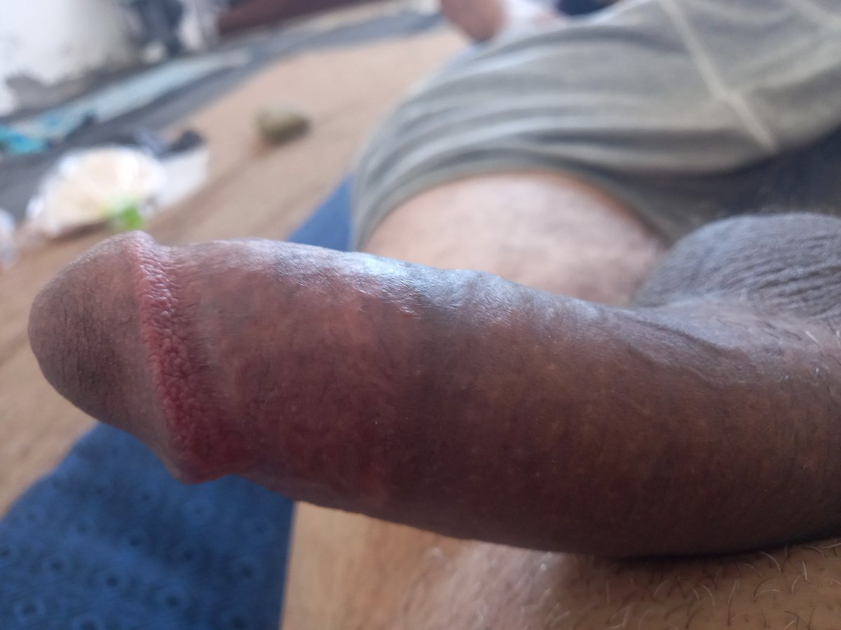 حمدى (@q5oq1pytie8yyvx) on Twitter photo 