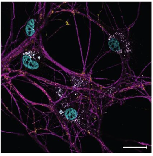 Towards the development of magnetomechanical neuromodulation therapies, Gomez et al. explore the mechanisms by which magnetic nanodiscs induce neural firing. #cmbeYI <a href="/RomerosLab/">Gabriela Romero</a> <a href="/BmeUtsa/">BME UTSA</a> <a href="/ChemicalUtsa/">UTSA Chemical Engineering</a>

link.springer.com/article/10.100…