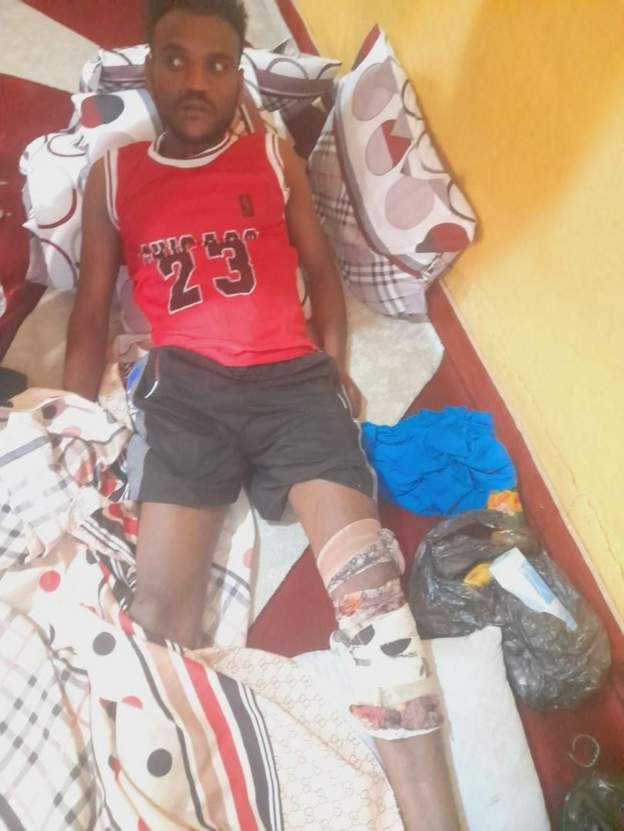A young Ethiopian man who jumped out of the window of a moving bus to save a 10-year-old boy from drowning has been hailed an "angel".

Abdi Tufa, broke his leg and is being cared for by the boy's family, but says he's happy to have saved the child's life. bbc.in/45m5xpo