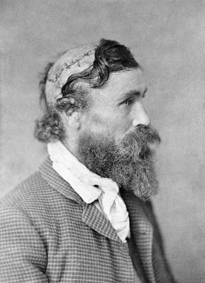 fasc1nate's tweet photo. In 1890, a remarkable photograph was taken. It captured the scars of a little-known American man. He was a survivor of an unimaginable ordeal in American frontier history.

The picture would continue to pass down through the ages. It was a reminder of not only a distant time in American history but of the individual it depicted – Robert McGee.

The story of Robert McGee, a young orphan who embarked on a westward migration in search of a better life, is a captivating one to behold. Little did he know that his journey would lead him to a fateful encounter with Sioux warriors.

This encounter left him scarred but defiantly alive. His flesh was ripped from his skull in a brutal scalping incident. It occurred in the summer of 1864 when he was just 14 years old.

How did he manage to endure such a horrific event? And what do his ordeal and subsequent survival reveal about the era he lived in?

McGee’s journey is, at the same time, one of resilience, legend, and the astonishing will to survive against all odds.