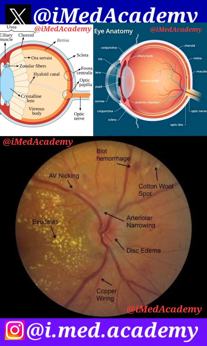 iMedAcademy's tweet photo. 🔆 #Ophthalmology 🔆
🔅 #EyeDiseases 🧐
○ Anatomy of Human Eye.
#anatomy #Physiology #Ophtha
#iMedAcademy #iMedMedicine
#medicine #surgery #MedTwitter #MedEd #iMed #iMedLab #Med
#NEETUG #MedX #Doctors #NExT
#MedicalStudents #MBBS #BDS
#NEET #FMGE #NEETPG #INICET https://t.co/txLzPSSKBO