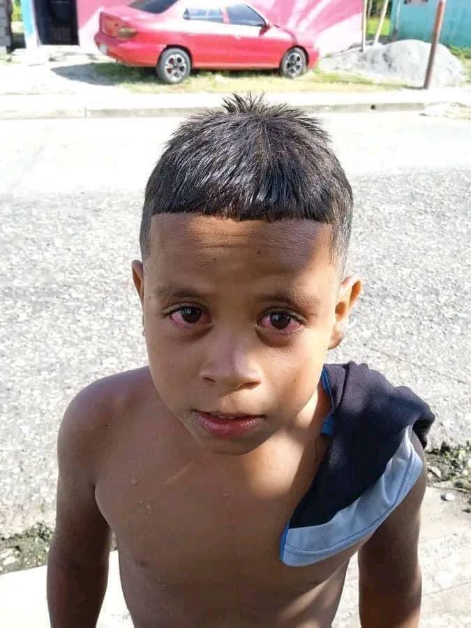 itatuaba's tweet photo. Nunca deu perdido pra ir no rio e voltar com o olho que é uma bomba, e diz que é cria https://t.co/mj3U5Me3U2