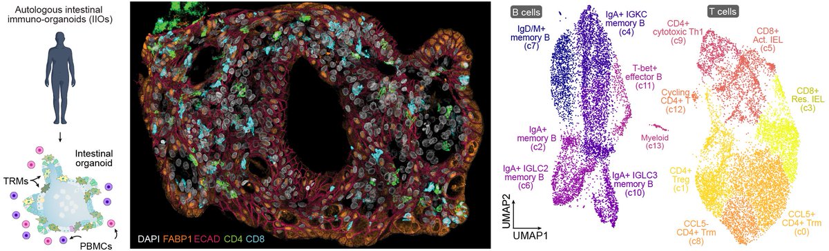 Gray Camp (@graycamplab) on Twitter photo Human intestinal organoids with autologous tissue-resident immune cells biorxiv.org/content/10.110…. Incredible how they incorporate into the epithelium! Foundational tool for basic and translational research. Inspiring collab with Nikolche Gjorevski and <a href="/IHB_Research/">Institute of Human Biology</a>! #organoids Human intestinal organoids with autologous tissue-resident immune cells biorxiv.org/content/10.110…. Incredible how they incorporate into the epithelium! Foundational tool for basic and translational research. Inspiring collab with Nikolche Gjorevski and <a href="/IHB_Research/">Institute of Human Biology</a>! #organoids