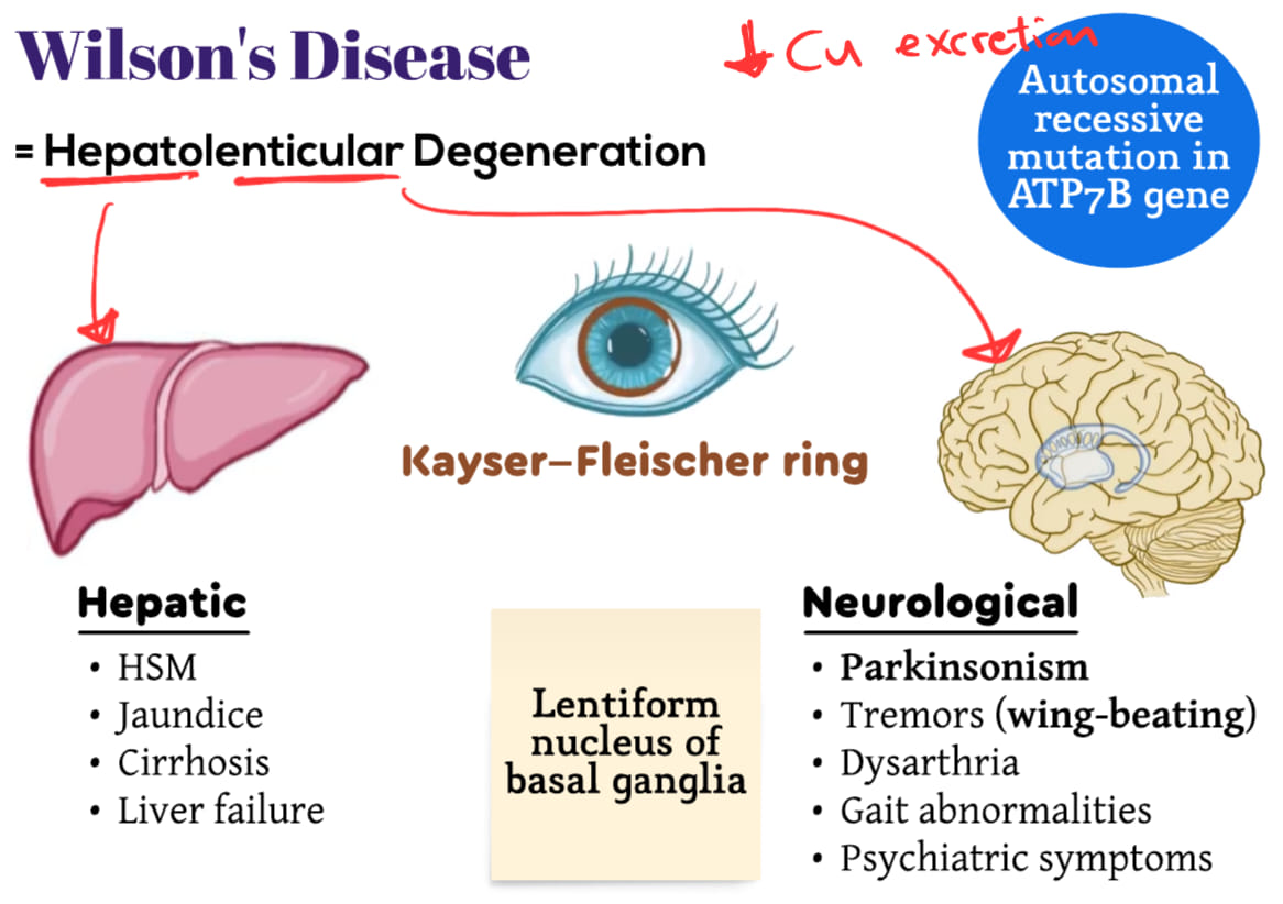 Medicine_keys's tweet photo. Features of Wilson's disease.
The full topic with its flashcards are available here,
https://t.co/LLHm53Zu7e

+1500 Flashcards in the form of short questions and answers are now available at https://t.co/sSGq8uW7XH and the number is rising daily . .

#MRCP
#MRCP_UK
#PACES https://t.co/qP1rzQjgU9