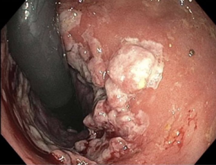 Keith Siau tweet media