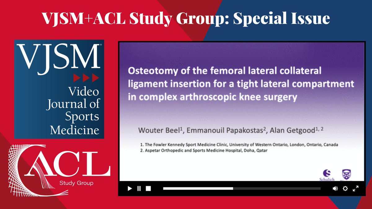 videojsportsmed's tweet photo. New #ACLStudyGroupVJSM shows way to ⬆️arthroscopic working space in tight lateral compartment: perform an osteotomy of the femoral insertion of the LCL utilizing novel adjustable loop refixation technique @FKSMC @FKSMC_Getgood @ACLStudyGroup
Watch here: https://t.co/mk0cJaAtqx https://t.co/4wGCWj6C5J