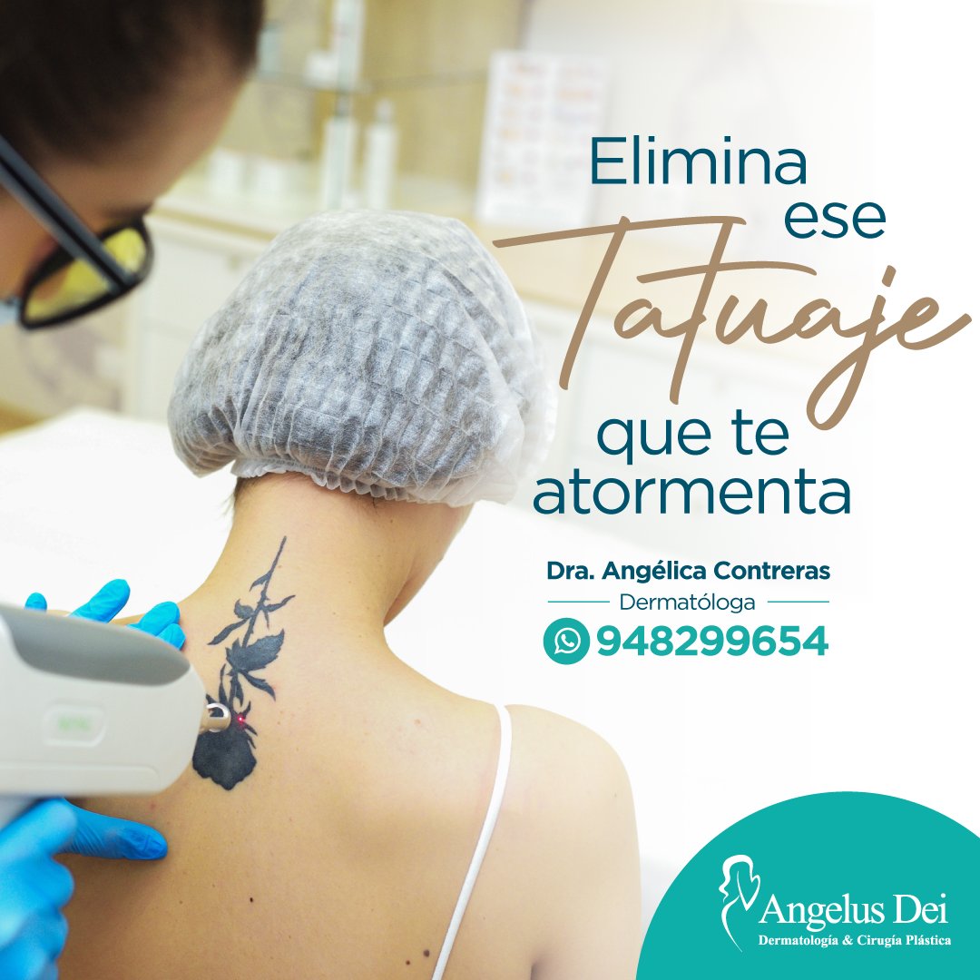 EMAngelusDei's tweet photo. ¡No tienes que quedarte con ese tatuaje para siempre! Gracias a las tecnologías de eliminación de tatuajes puedes decirle adiós. 
Dra. Angélica Contreras, Médico Dermatóloga y Especialista en Medicina Estética.📷
Separa tu cita https://t.co/lcKMJFrtEj https://t.co/XA9mmEmxki
