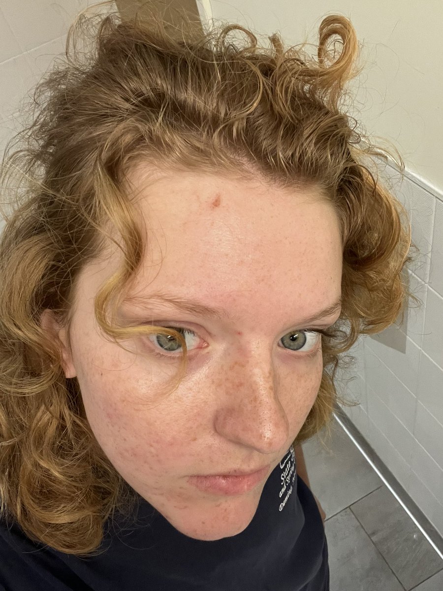 rilesbowen's tweet photo. Bumped my head on a tree trying to climb it. https://t.co/hyMovmDxa7
