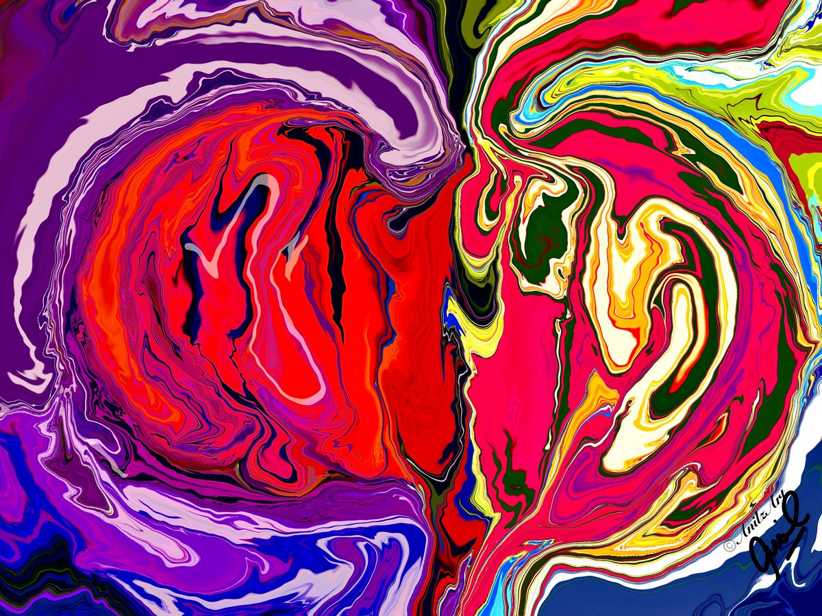 Dr. Anil Saxena MD, FRCP, FASN (@satya_jayate) on Twitter photo My e painting : Focal Segmental Glomerulosclerosis ( FSGS)
#Anilzart
#Glomerulus
#Fibrisis
#Kidneyfailure My e painting : Focal Segmental Glomerulosclerosis ( FSGS)
#Anilzart
#Glomerulus
#Fibrisis
#Kidneyfailure