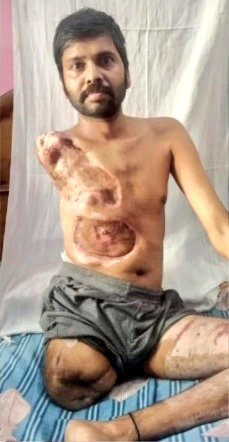 (सबसे सस्ता #UP_में)जल्दीआओ,जल्द पाओ
#8_हजार में बिजली संविदा कर्मचारी का 
#हांथ_ले_लो,
#रोटी_भी_ले_लो,
#बच्चों_का_भविष्य_ले_लो,
#पत्नी_की_खुशियां_ले_लो,
#नौकरी_ले_लो,
#जान_भी_ले_लो,
<a href="/UN/">United Nations</a>
<a href="/PMOIndia/">PMO India</a>
<a href="/nitin_gadkari/">Nitin Gadkari</a> <a href="/CMOfficeUP/">CM Office, GoUP</a> <a href="/BBCHindi/">BBC News Hindi</a> <a href="/RahulGandhi/">Rahul Gandhi</a> <a href="/BJP4UP/">BJP Uttar Pradesh</a> <a href="/Bmastrust/">भारतीय मानव अधिकार संरक्षण ट्रस्ट</a> <a href="/cgsvskm/">छ.ग. सर्व विभागीय संविदा कर्मचारी महासंघ (CGSVSKM)</a>