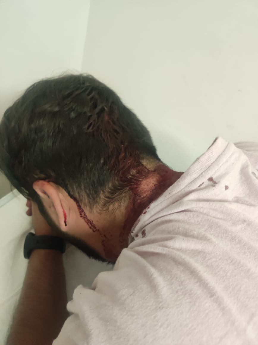 alfagonzalezm's tweet photo. En los primeros minutos de este día, una brigada de compañeros fueron violentados físicamente por un grupo de golpeadores encabezado por personas directamente ligadas a las campañas de @Carlos_UlloaP y @OHarfuch.
Nuestros compañeros se encontraban realizando la difusión del 2o Informe de Labores de la Alcaldía, cuando fueron atacados directamente por un grupo de personas encabezadas por personas plenamente identificadas con dichos aspirantes a cargos en @PartidoMorenaMx .
Presentaremos la denuncia correspondiente por las agresiones y lesiones sufridas por nuestros compañeros, para que los autores materiales e intelectuales de estos hechos no queden impunes.
Pido al Jefe de Gobierno @martibatres , su inmediata intervención para que estas conductas sean sancionadas y no vuelvan a repetirse. 
Y pido también a la Fiscal General @ErnestinaGodoy_ una investigación que no encubra a los autores de estos hechos lamentables.

La @TlalpanAl que encabezo refrenda su compromiso con el Estado de Derecho y las instituciones de justicia.

Esta Alcaldía, como lo ha hecho hasta ahora, refrenda su decisión de no intervenir bajo ninguna modalidad en los procesos internos de ningún partido político. Por lo que solicita al Gobierno de la Ciudad y a la dirigencia del partido Morena a no promover este tipo de prácticas bajo ningún concepto.
Anuncio también que vamos a continuar, en el marco que nos permite la ley, con la difusión de los logros y acciones realizadas en esta administración al frente de la Alcaldía. Por lo que pedimos al Gobierno de la Ciudad genere las condiciones para llevar a cabo este ejercicio de rendición de cuentas.
El odio y la violencia no debe ser permitido ni promovido bajo ninguna causa.
Estos no son tiempos de deteriorar aún más la convivencia democrática. No lo será de nuestra parte. Por lo que es responsabilidad de todos los actores políticos cuidar el nivel y la convivencia política y social.