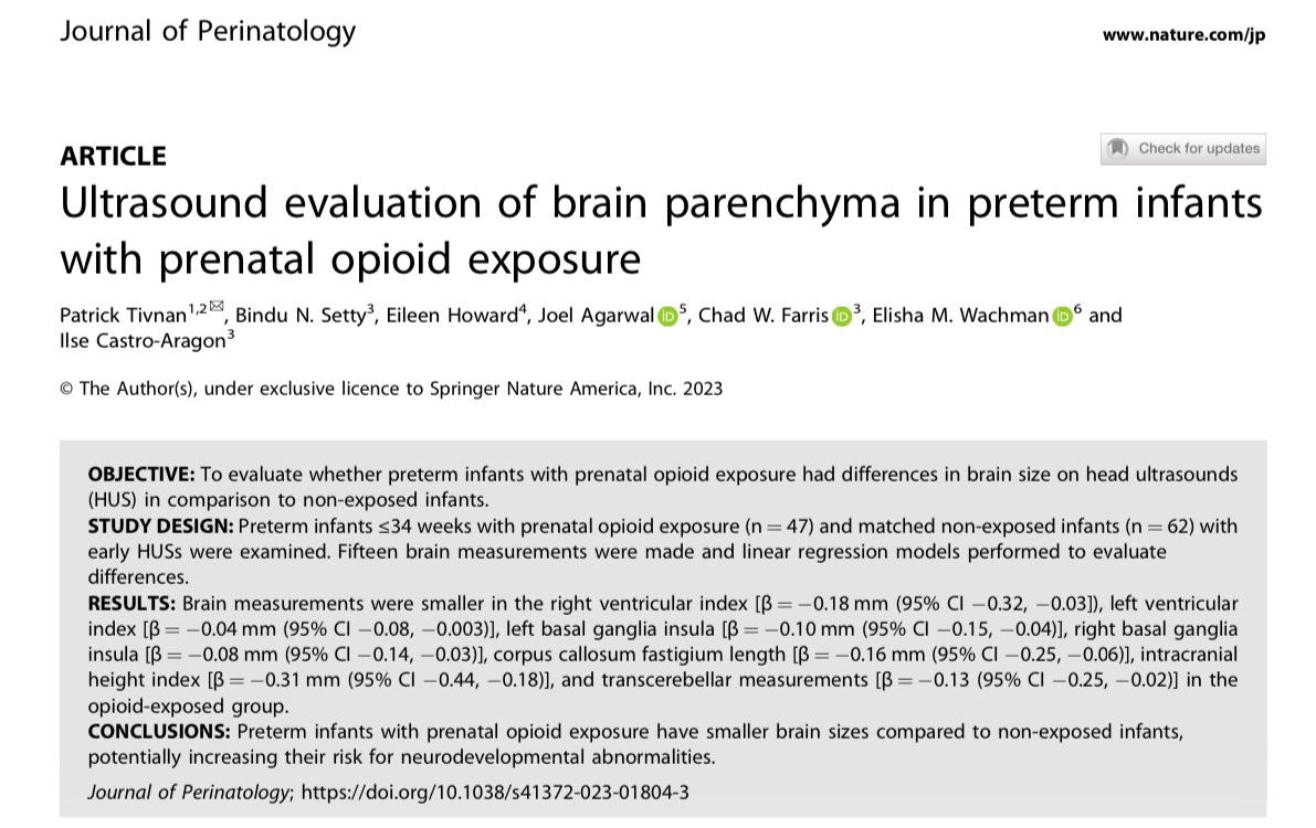 joel_agarwal's tweet photo. 🎉Our article is published! 🎉

We show that preterm infants with prenatal opioid exposure have smaller brain sizes compared to non-exposed infants, potentially increasing their risk for neurodevelopmental abnormalities. #AcademicTwitter 
@The_BMC @elisha_wachman @JPerinatology https://t.co/PN3LnyjzAr