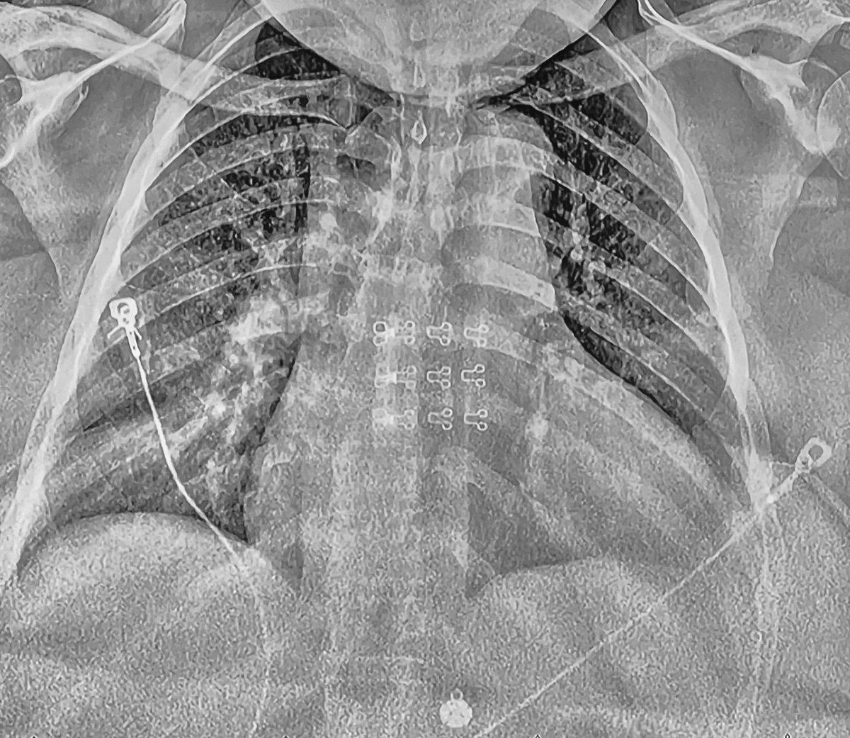 Sandeep Nathan, MD, MSc tweet media