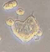 When your cells trully love you... ❤️