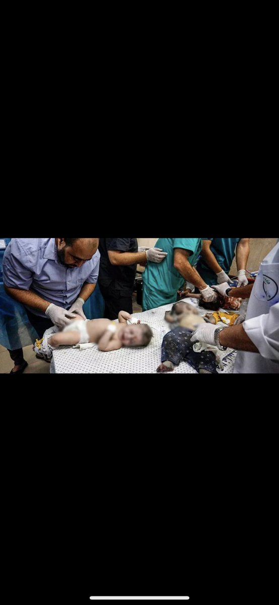 Babies in Gaza unfortunately struggle with malnutrition and hunger. Maybe they will die hours later. Why doesn't anyone see or hear? #LetGazaBabiesLive