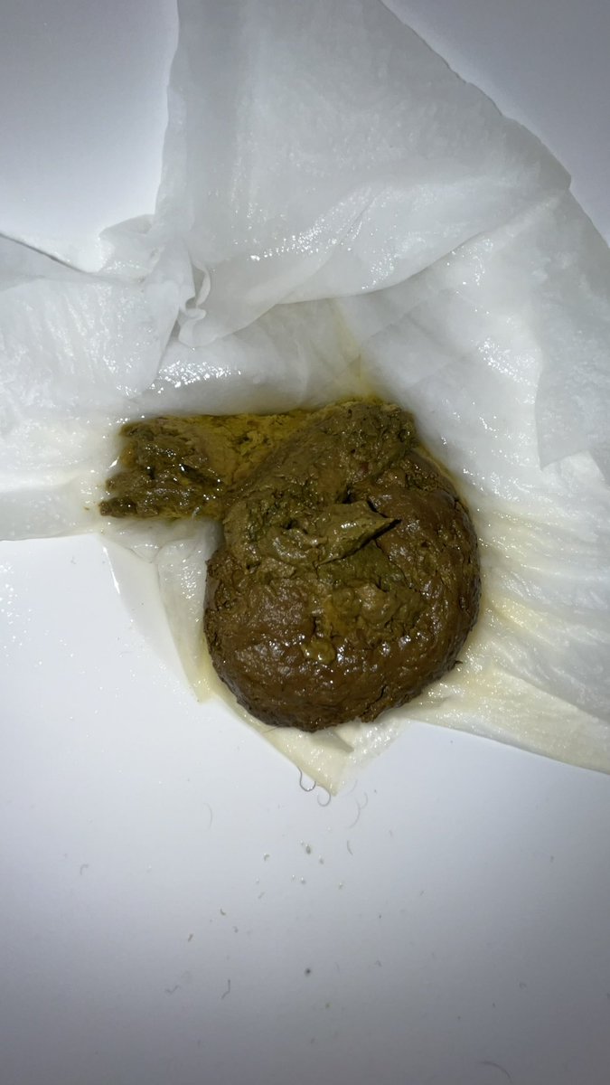 I1ovep00p's tweet photo. This was amazing I loved pushing it out my dirty hole but it’s a shame no none was there to eat it #dump #faggotboy #gay #gayscat #horny #ilovepoop #kink #poop #porn #scat #shit # https://t.co/43eFkRJuuA