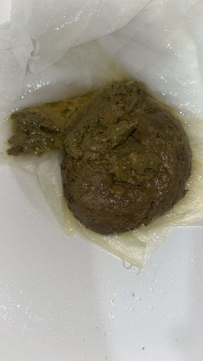 I1ovep00p's tweet photo. This was amazing I loved pushing it out my dirty hole but it’s a shame no none was there to eat it #dump #faggotboy #gay #gayscat #horny #ilovepoop #kink #poop #porn #scat #shit # https://t.co/43eFkRJuuA