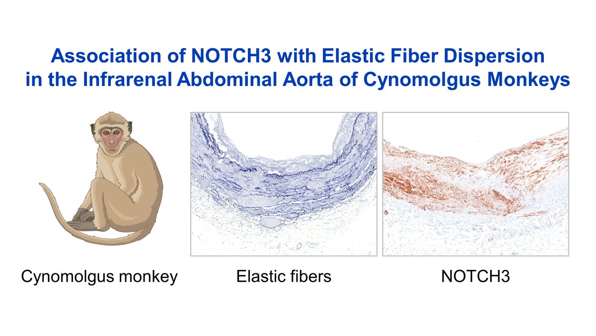 Association of NOTCH3 With Elastic Fiber Dispersion in the Infrarenal Abdominal Aorta of Cynomolgus Monkeys | Arteriosclerosis, Thrombosis, and Vascular Biology ahajournals.org/doi/10.1161/AT…