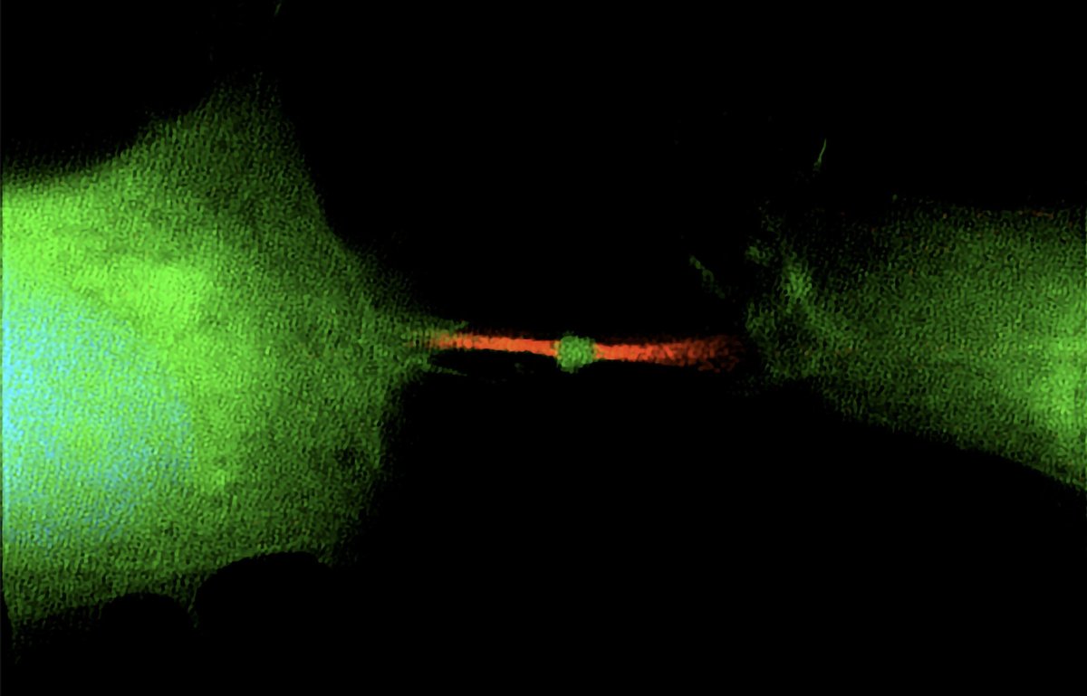 UW–Madison CALS (@uwmadisoncals) on Twitter photo The Skop lab in <a href="/uwgenetics/">UW Madison Genetics</a> and collaborators recently discovered that a remnant of cell division could be responsible for spreading cancer. Learn more at news.wisc.edu/remnant-of-cel…. <a href="/foodskop/">Dr. Ahna Skop, Ph.D.</a> The Skop lab in <a href="/uwgenetics/">UW Madison Genetics</a> and collaborators recently discovered that a remnant of cell division could be responsible for spreading cancer. Learn more at news.wisc.edu/remnant-of-cel…. <a href="/foodskop/">Dr. Ahna Skop, Ph.D.</a>