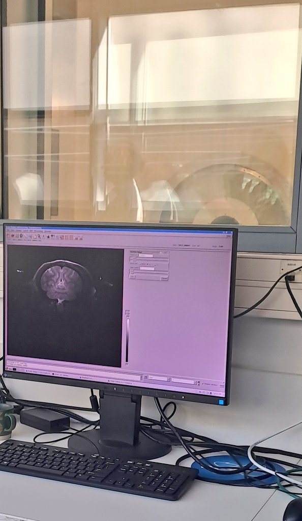 CEA_Jacob_'s tweet photo. [🔬#visite] Retour sur la visite du jour à #MIRCen en compagnie du réseau #TechSanté ,  la @CCI_Paris_IdF et du @vallee_sud #BIOPARC pour découvrir les plateformes d'#imagerie et de #radiochimie dédiées aux travaux sur les maladies #Neurodégénératives 🧠. https://t.co/YUrwq8EbyT