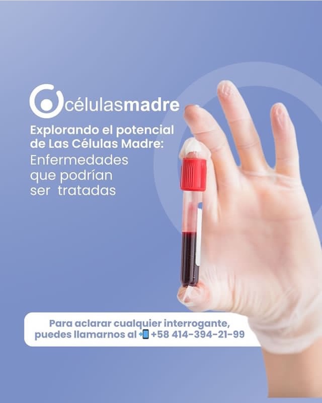 celulasmadrela's tweet photo. En la actualidad, se están llevando a cabo investigaciones y ensayos en los que se emplean células madre para la creación de células y tejidos destinados al tratamiento de diversas enfermedades. Entre ellas se encuentran el Parkinson, el Alzheimer ...
👇🏼
https://t.co/TV6SgC8lTM https://t.co/2XEoA6Y7lz