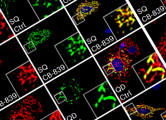 DouglasAdamoski's tweet image. Starvation triggers not only mitochondrial tubulation but also a cunning  evasion of mitophagy. It begs the question - could this impairment in  cellular recycling be a hidden link to neuronal and developmental  disorders? We&apos;re on the hunt for answers! 🔬🧠 #ResearchQuestions