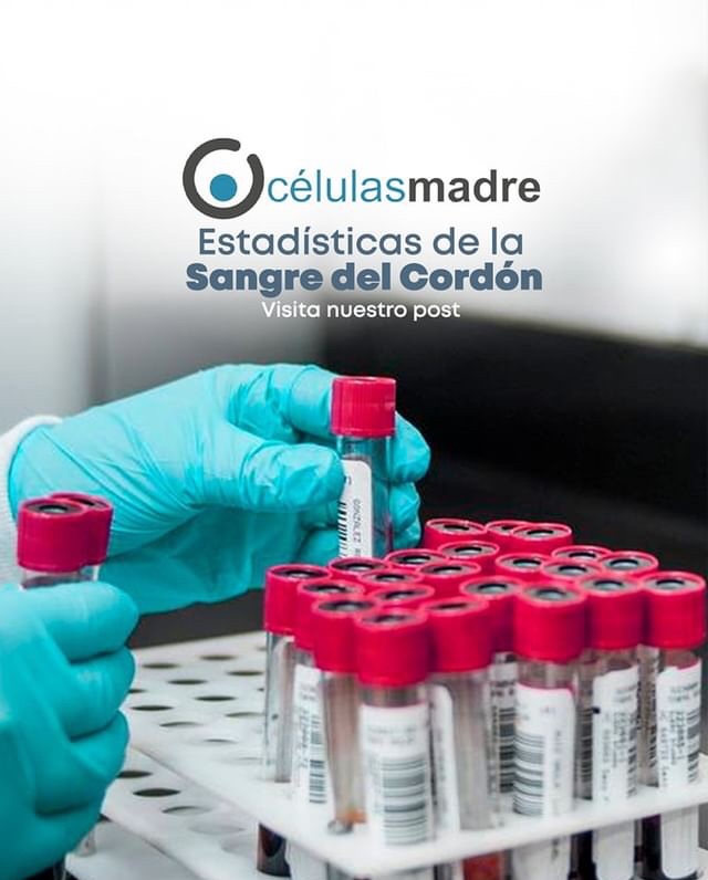 celulasmadrela's tweet photo. -El 62,7% de los trasplantes de Sangre de Cordón Umbilical se utilizan de manera segura en el tratamiento de la leucemia.
-Desde 2005, se ha tratado a 552 pacientes con leucemia linfoblástica aguda mediante un trasplante de Sangre de Cordón Umbilical...
👇🏼
https://t.co/TV6SgC8lTM https://t.co/yCI2Ur4HVE