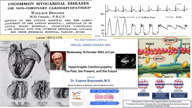 A fantastic lecture by Eugene Braunwald at the Royal Brompton Grand Rounds: in 5 decades from pathology, hemodynamics, genetics and management of hypertrophic cardiomyopathy - an impressive life time achievement. Listen to it at vimeopro.com/zurichhearthou…